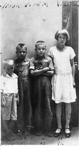 Children of J.D. Tillman - victims of hookworm: Leon County, Florida (1931)