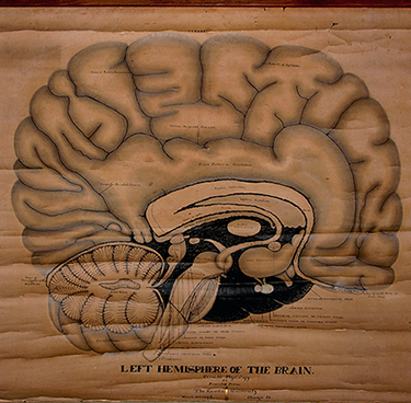 Teed's chart of the brain, March 11, 1896