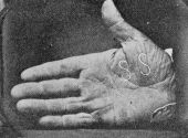 Faithful facsimile of daguerreotype taken of Captain Jonathan Walker's branded hand